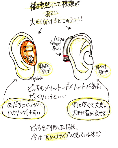 【補聴器の違い】