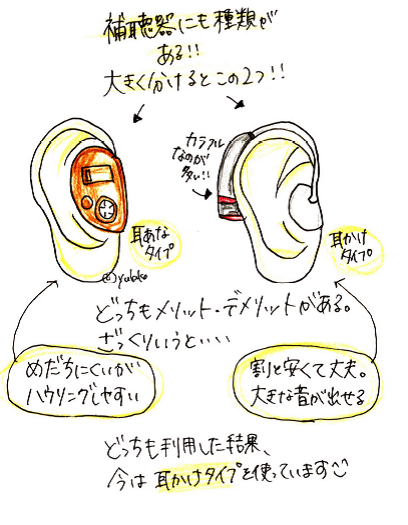 補聴器 イヤホン セール 違い