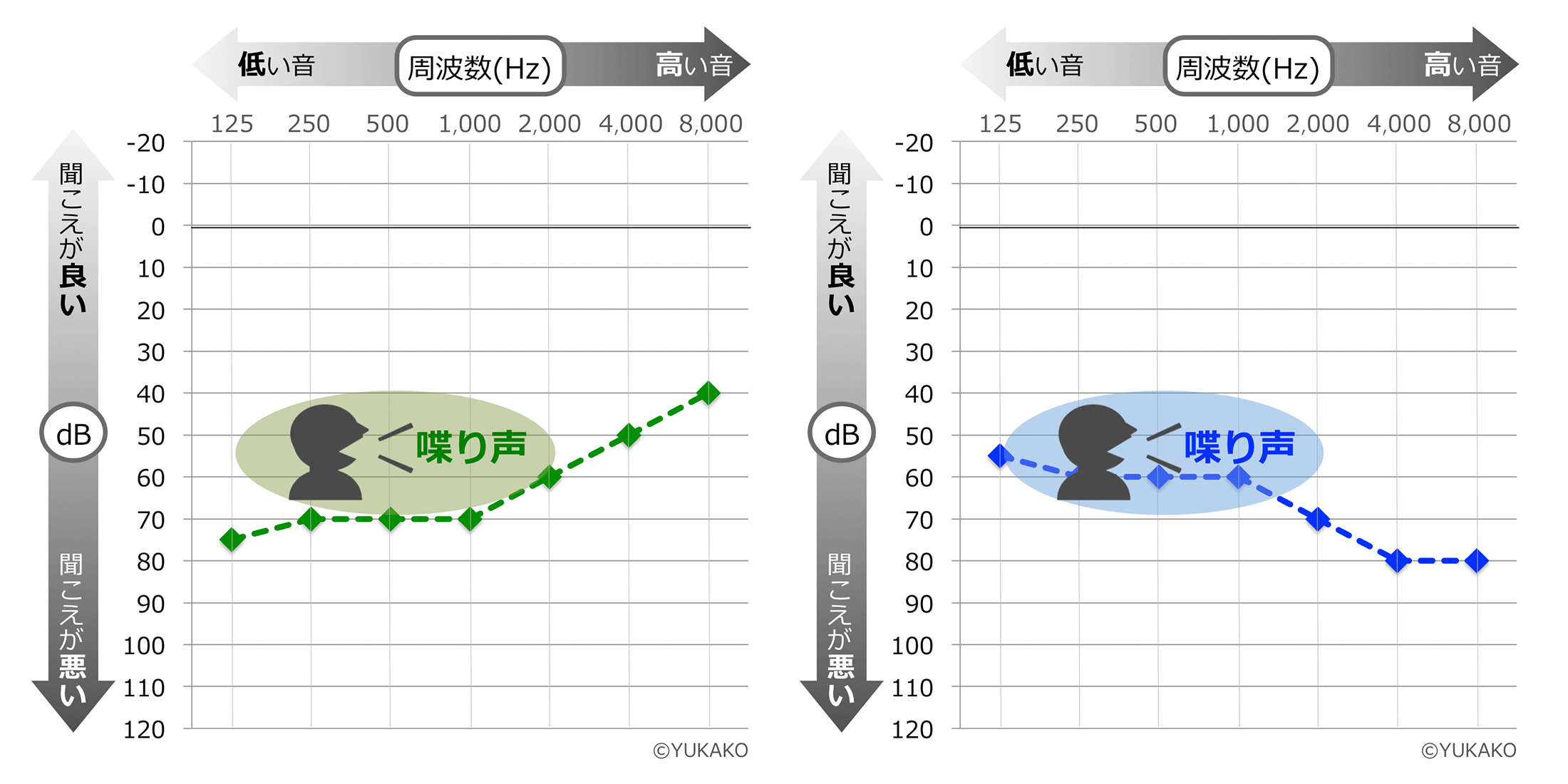 聴覚を失っているのでしょうか？難聴とは何かを知る
