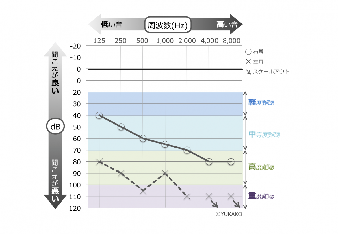 ここだけは必ず確認すべき 聴力検査結果 オージオグラム の徹底解説 デフサポ